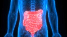 Mikroskobik kolit: Birçok kişide teşhis edilmemiş veya yanlış tanı konulmuş bağırsak rahatsızlığı